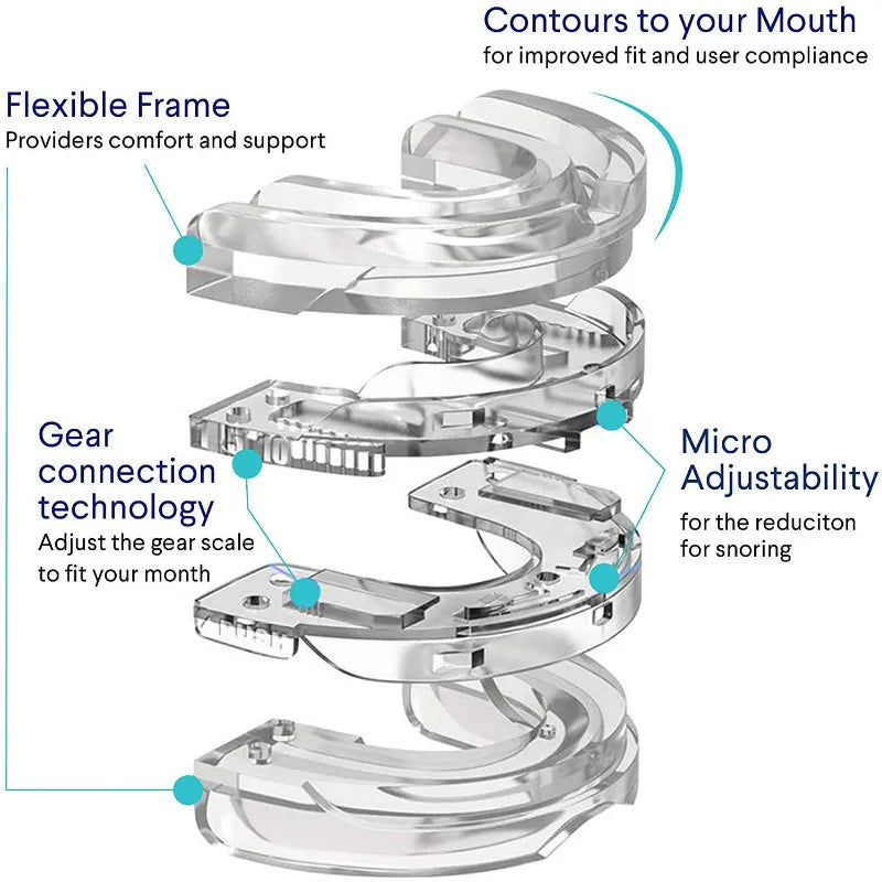 Z Comfort | Anti-snoring device | 2024 Hot Sales 70% OFF