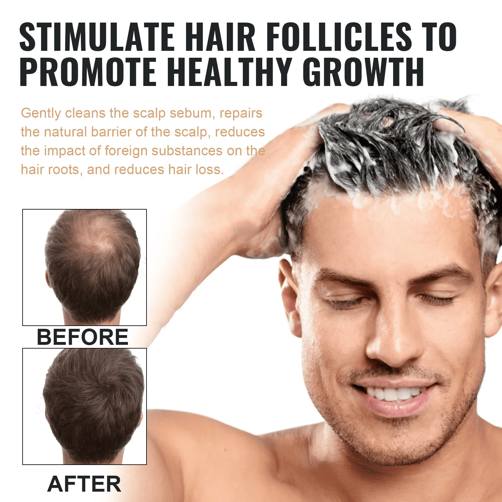 SPARTAN Root Activator Shampoo - Increased Hair Growth with Just 4 Washes a Week* - Nilola