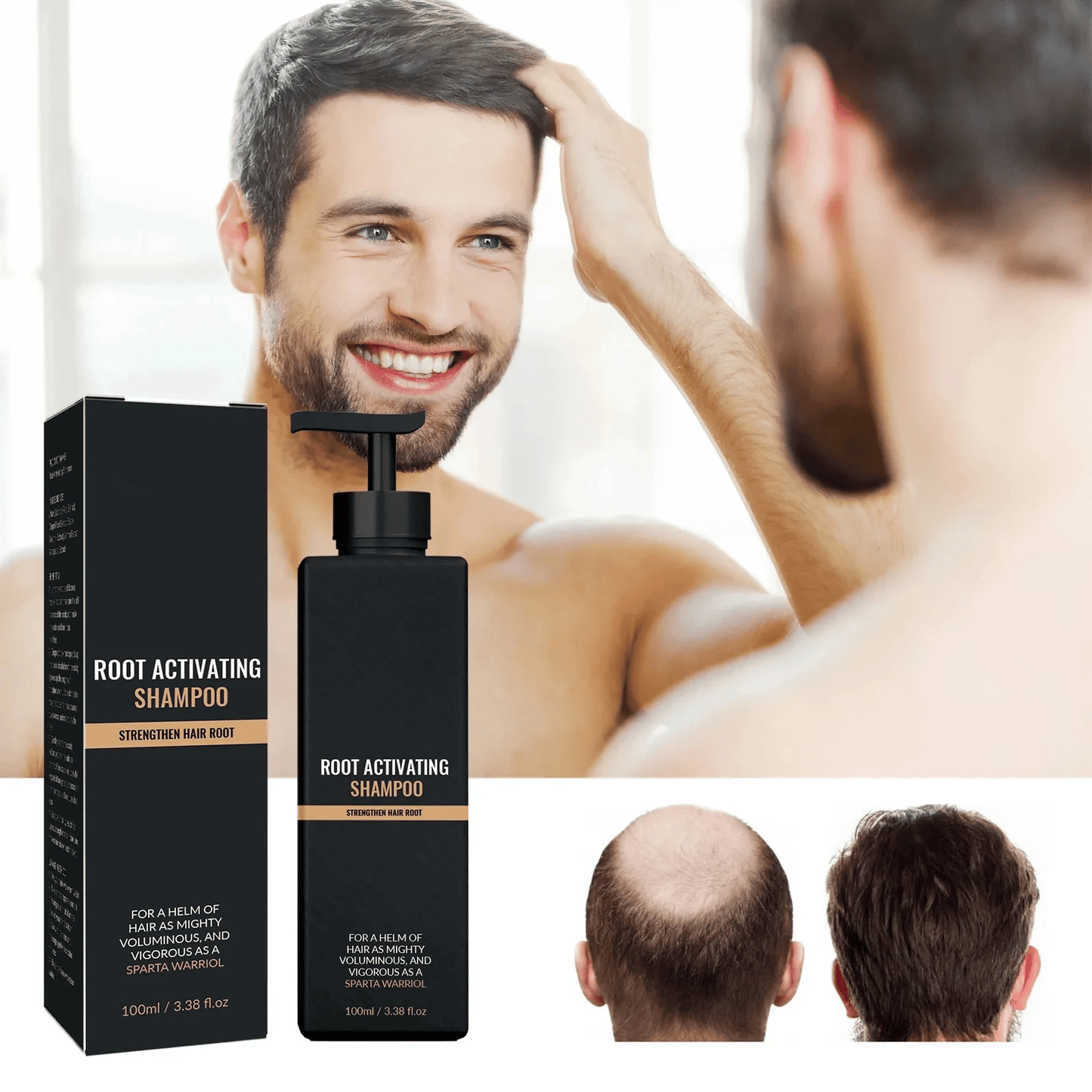 SPARTAN Root Activator Shampoo - Increased Hair Growth with Just 4 Washes a Week* - Nilola