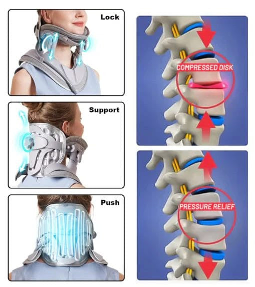 #1 Rated Neck Traction Device - Hot Sale 50% Off