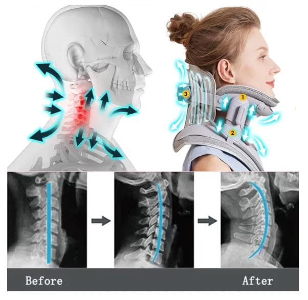 #1 Rated Neck Traction Device - Hot Sale 50% Off