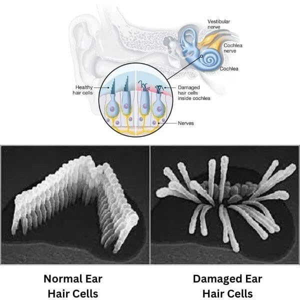 Digital Pro Hearing Aids - Hot Sale 50% Off