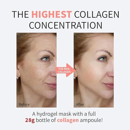 Deep Anti-Wrinkle Lifting Mask